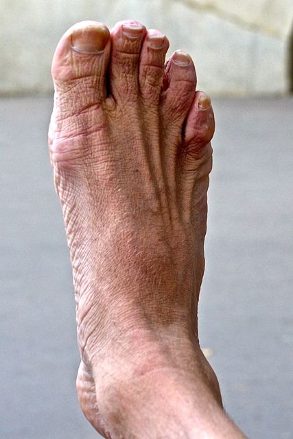 Combien d'os, de muscles et de tendons, déjà ? 